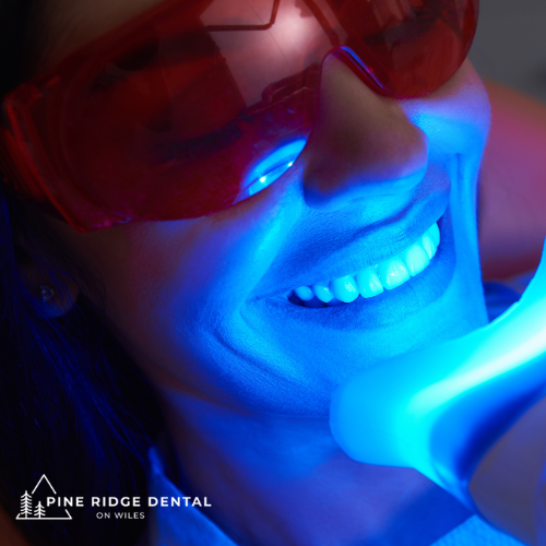 teeth whitening Coral Springs - Pine Ridge Dental on Wiles