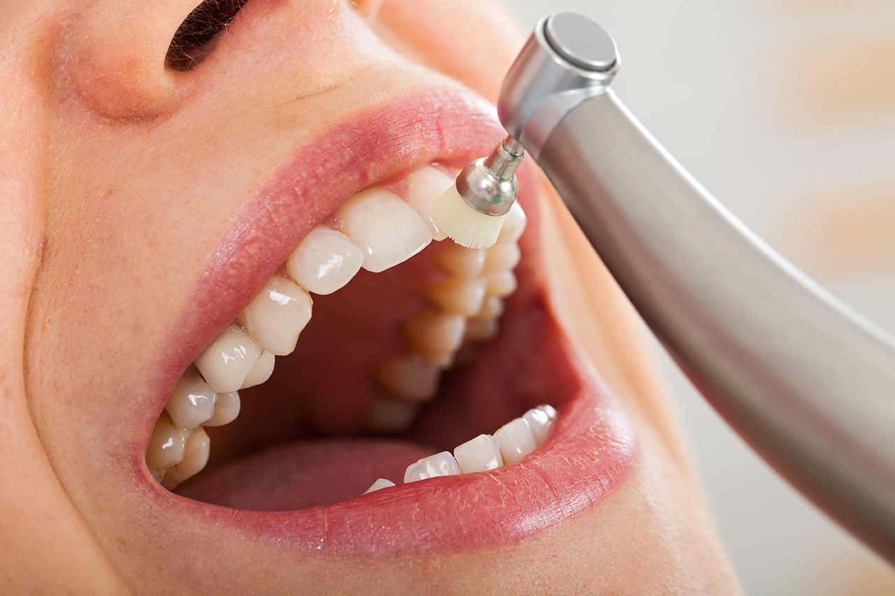 Pine Ridge Dental on Wiles | Teeth Cleaning In Coral Springs: Maintain a Healthy, Bright Smile