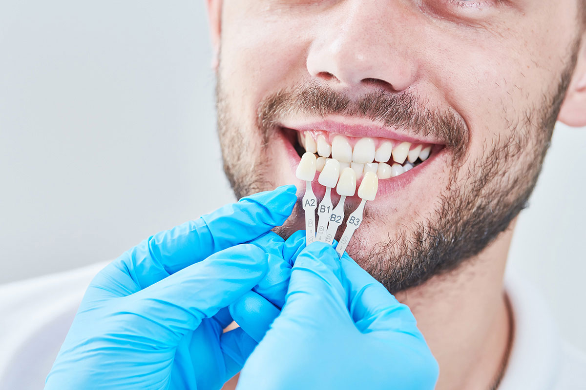 Pine Ridge Dental on Wiles | Porcelain Veneers In Coral Springs: A Personalized Approach To Smile Enhancement
